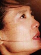 小蕓